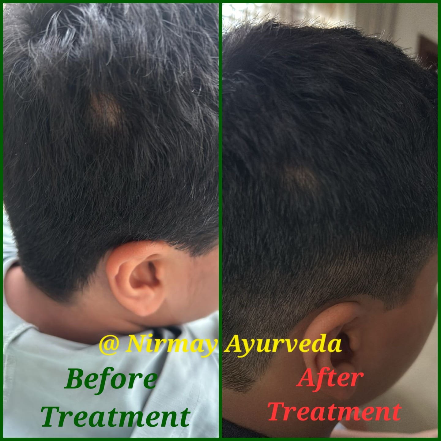 Hair Treatment Before After