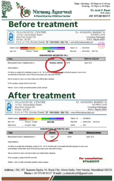 RA Factor Before After Report